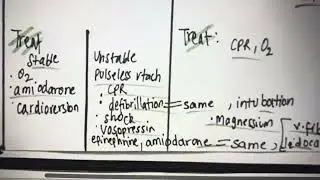 Ventricular tachycardia v/s ventricular fibrillation 