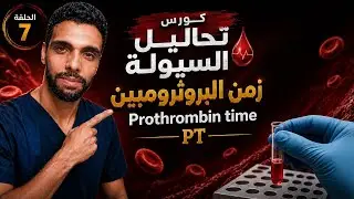 زمن البروثرومبين Prothrombin time