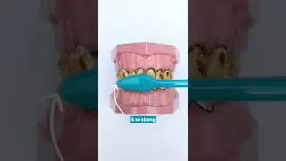 Plaque Attack?! Here's An Anti-Plaque Hack...