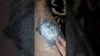 Remove Tattoo at home #tattoo #tattooremoval #shorts