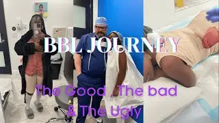 I flew to Miami to get a BBL without telling anyone 🤫 BBL journey | 305 plastic Surgery | Dr.William