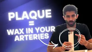 How Plaque Actually Forms (And How to Test Your Real Risk)
