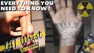 how to: LATERAL WRIST X-RAY positioning tips || Ask The Rad Tech