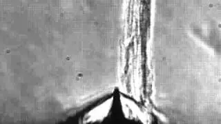 Bundle of myofibrils contracting