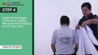 Burn on the Back