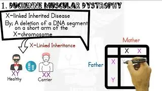 Muscular Dystrophy- Duchenne, Becker's, Myotonic | Pathology