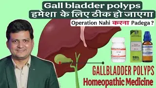 Gall bladder Polyps | Best Homeopathic Medicine for Gall bladder Polyp | Explain ?