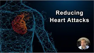 How To Reduce The Majority Of Heart Attacks And Strokes - Kim Williams, MD - Interview