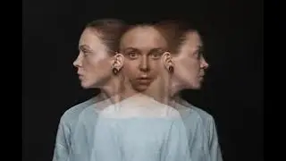 Dissociative Stress Disorder; Multiple Personality; Case studies: -74. #multiplepersonalitydisorder