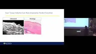 MED Talks: Automated Tendon Scar Tissue Identification