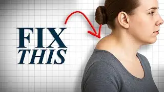 NECK HUMP - 2 Types & How to FIX IT (FREE PDF Inside)