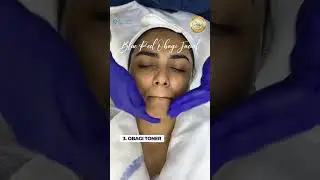 OBAGI Blue Peel Radiance Facial