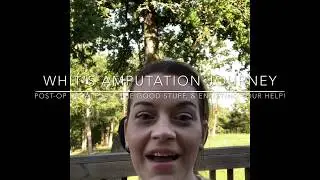 Above Knee Amputee - Post-Op Update, All the Good Stuff, & Enlisting Your Help!
