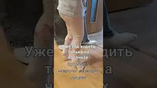 Год девочка ходит только на носочках. В области плюсны уже  мозоли наросли #дети #массаж