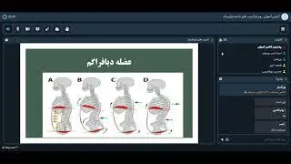 آسیب های تورآسیک #fitnessfire #gymlife #gymtok #ورزشی #آسیب