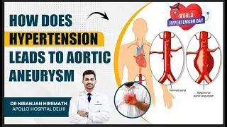 World Hypertension Day | How Does HYPERTENSION Leads To Aortic Aneurysm | Dr Niranjan Hiremath