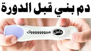 الفرق بين دم الحمل ودم الدورة الشهرية | نزول دم قبل ميعاد الدورة هل حمل | نزول دم بني قبل الدورة