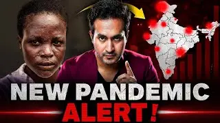 ALERT! New PANDEMIC is Spreading Across The World | MPOX Virus Explained