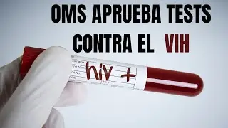 OMS aprueba tests  contra el VIH