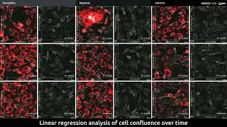 Multi-well, time-lapse imaging of live pre-adipocytes perturbed by different drugs