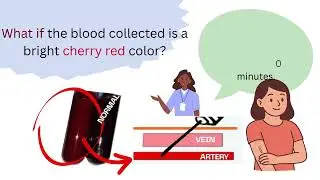Phlebotomy Troubleshooting Quiz: 10 'What If' Actions for Real-World Success