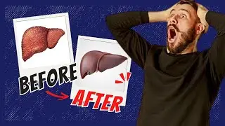 Top 10 Foods to CLEANSE & REPAIR Your Liver (Beat Fatty Liver!)
