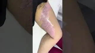 #salosalillari #wax #viral #brazilianwax #waxingvideos #waxing #depila&ccedil;&atilde;o #brazilianwax  #hotwaxing