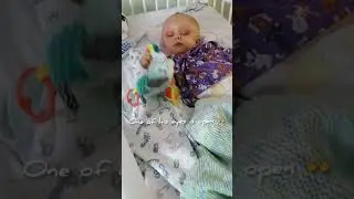 Our Baby's Cranial Vault Remodeling Post-Op | Days in the Hospital | Part 1