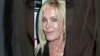 How did Joan Van Ark transform through plastic surgery? #shorts