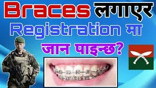 Braces on Registration // Detail .