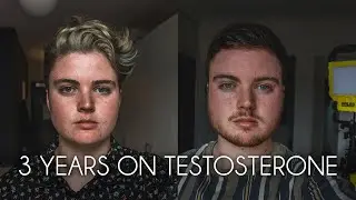3 YEARS ON TESTOSTERONE COMPARISON // FTM Transgender transition australia