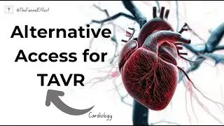 Alternative Access for TAVR