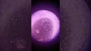fly blood under microscope