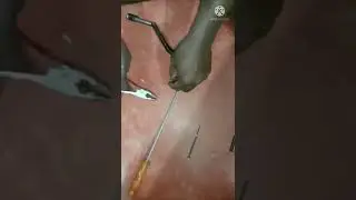 Tvs Apache bike kicker repairing