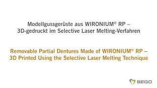 BEGO Selective Laser Melting &ndash; Removable Partial Denture Frameworks made of WIRONIUM&reg; RP