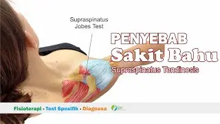 Pemeriksaan  Bahu - Supraspinatus Jobes Test - Peradangan Otot Supraspinatus