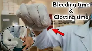 Bleeding time and Clotting time determination | BT CT test | Coagulation time