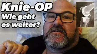 Knie Operation (Knie TEP Implantation) - Wanderung - mein Bericht vom Krankenhaus und Reha