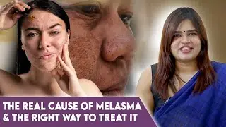 Melasma Solutions: Causes, Treatments & the Dangers of DIY Fixes | Dr Radha Subramaniyan