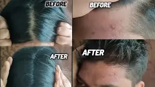 ദൈവമേ ഇതായിരുന്നോ😱Tried Viral Hair Building Fibres &Hair sketch Pen⚡