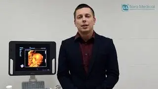 УЗИ сканер Mindray DC-N3. Обзор и отзыв