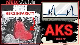 Kardiologie in unter 9min (STEMI/NSTEMI, Aortendissektion, Symptome & mehr)