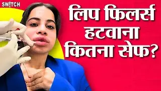 Urfi Javed ने Lip Fillers क्यों हटवाए? पूरी सच्चाई जानिए