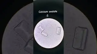 Seman test examination #post #lab #microscope #hospital #medical #fypシ゚viral #nurse #lab #minivlog