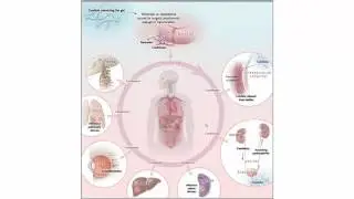 Invasive Fungal Infection in the ICU 08192016