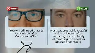 Contoura LASIK
