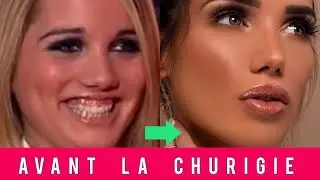 Les stars de télé-réalité avant la chirurgie esthétique 🤔😱🤭| Manon,  Nabilla, Maeva Ghennam, Paga