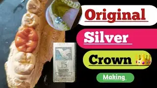 Original silver crown 👑|| Silver White metal| dental technician video|| laboratory| anatomy| Ceramic