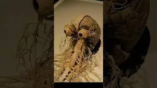 운동하면 뇌 신경이 이렇게 변합니다 ㅠ