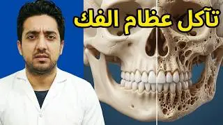 Causes of Jawbone Loss
